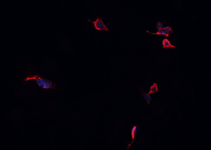 Polyclonal Rabbit anti-Human GABRA2 Antibody (IHC, IF, WB)