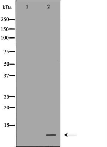 TFF3 / Trefoil Factor 3 Antibody