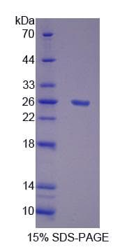Human POLG Protein (Recombinant His-S)
