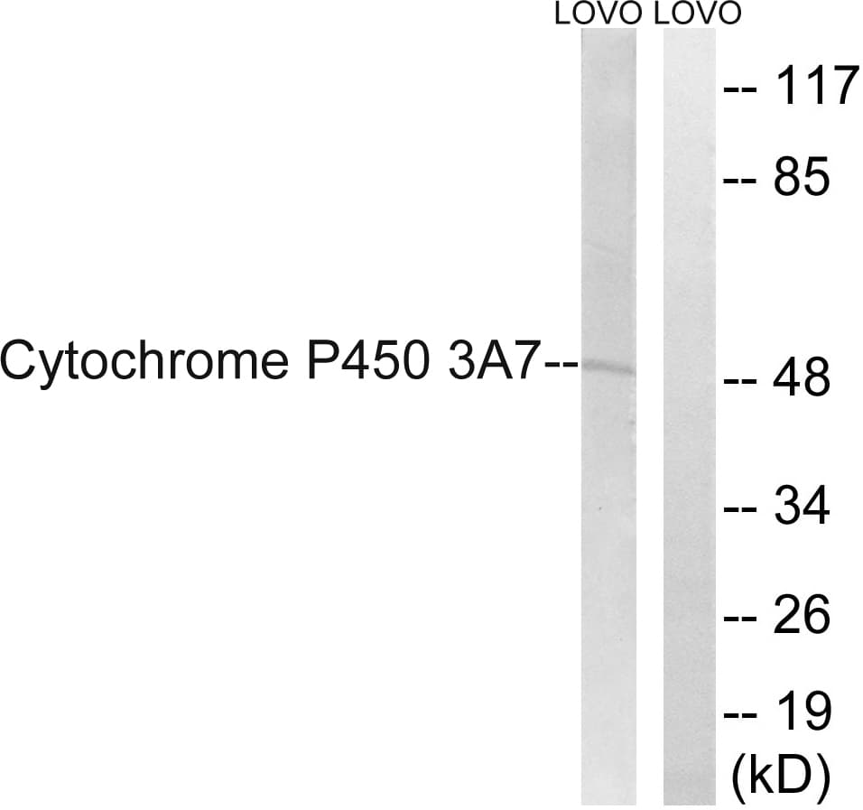 Polyclonal Rabbit anti-Human CYP3A7 Antibody (aa231-280, WB)