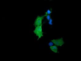 Monoclonal Mouse anti-Human TCL / RHOJ Antibody (clone OTI2C10, IHC, IF, WB)
