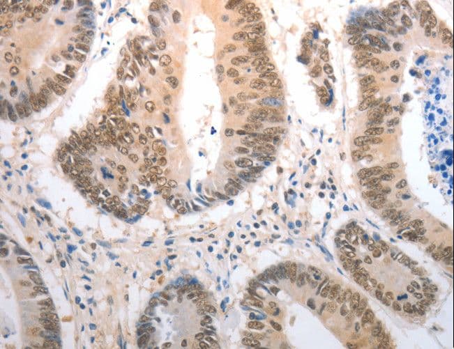 Polyclonal Rabbit anti-Human RAD50 Antibody (IHC, WB)