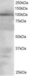 IHC-plus™ VAV2 Antibody (aa208-221)