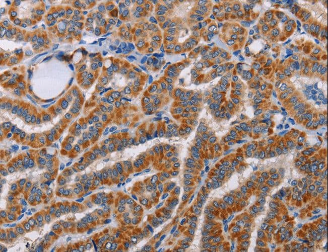 ALG9 Antibody