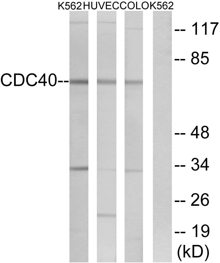 Polyclonal Rabbit anti-Human CDC40 Antibody (aa179-228, WB)