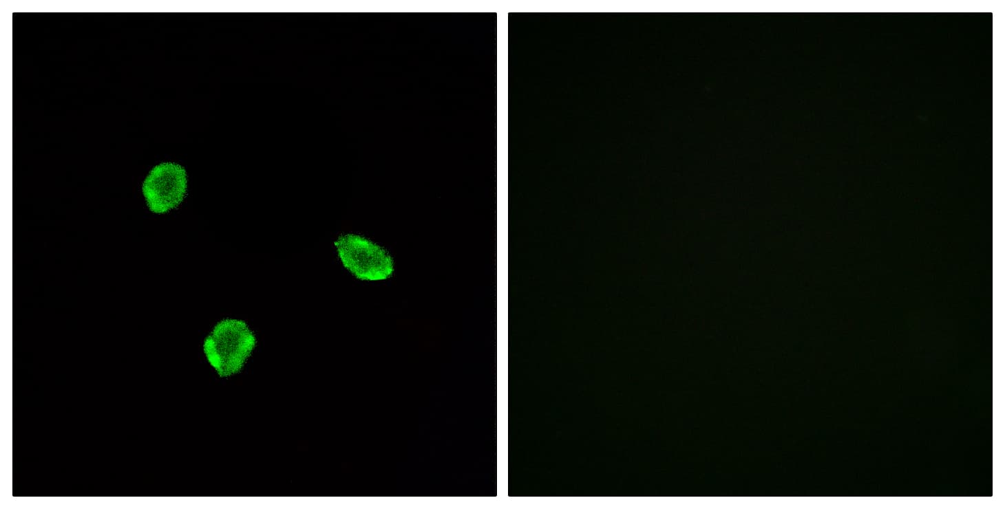 SSTR1 Antibody (aa9-58)