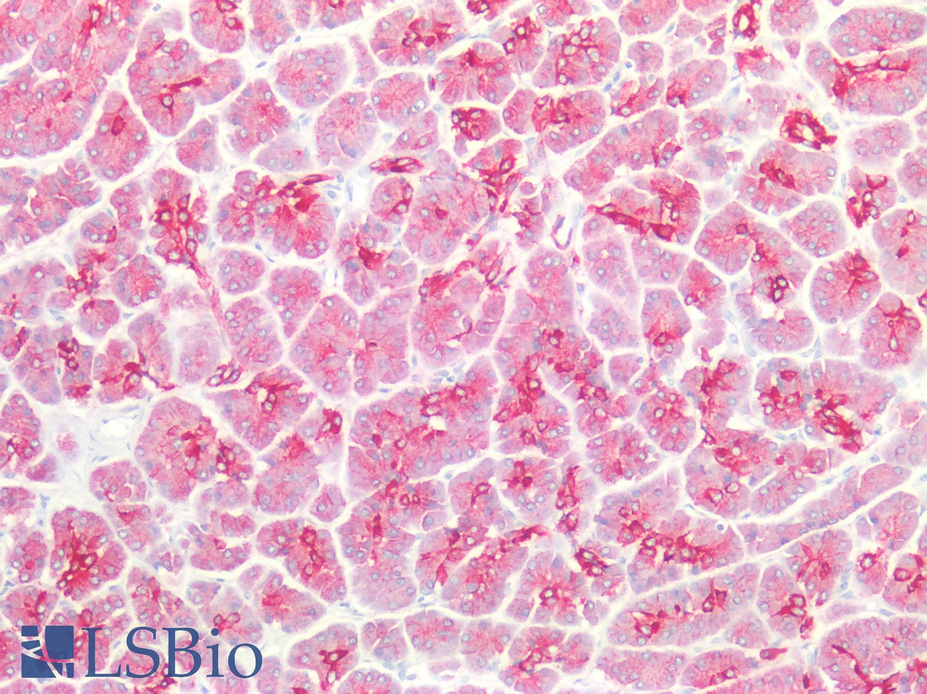 PathPlus™ Cytokeratin 8+18 Antibody (clone B22.1 & B23.1)