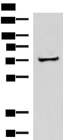 ZNF263 Antibody