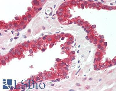 IHC-plus™ Polyclonal Rabbit anti-Human ZDHHC3 Antibody (IHC, WB)