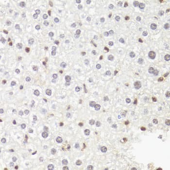 POLR2B / RPB2 Antibody
