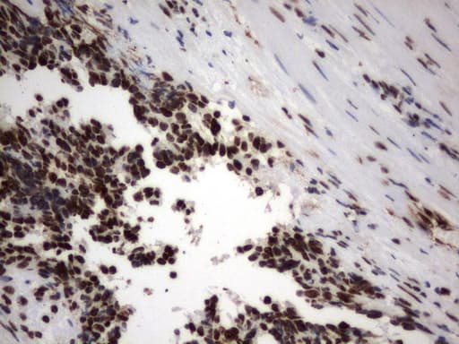 MLF1 Antibody (clone UMAB138, Carrier-free)