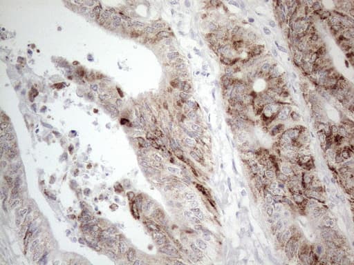 AMACR / P504S Antibody (clone OTI4D12)
