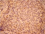HSPB1 / HSP27 Antibody (phospho-Ser15)