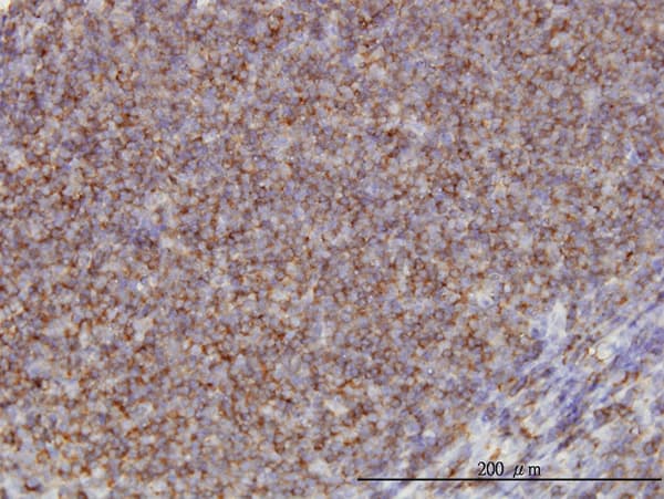 ADD1 / Adducin Alpha Antibody (clone 2C9)