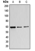 Polyclonal Rabbit anti-Human B4GALNT1 / GM2/GD2 Synthase Antibody (Internal, WB)