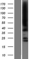 KDM8 / JMJD5 / FLJ13798 Protein (Over-Expression Lysate Myc-DDK (Flag))