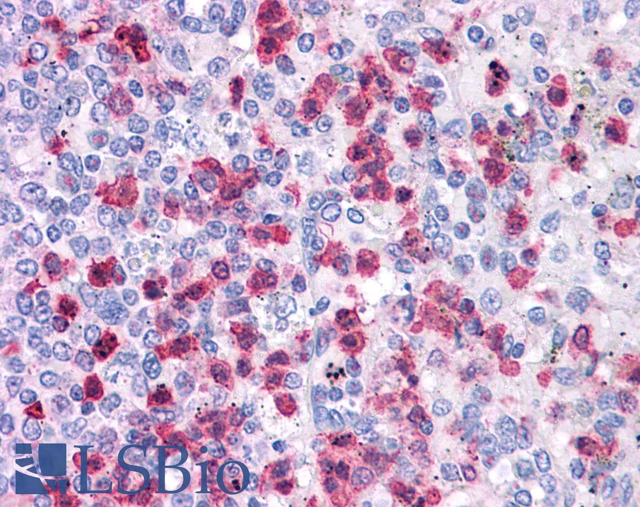 Polyclonal Rabbit anti-Human LRRC8B Antibody (aa542-591, IHC, WB)