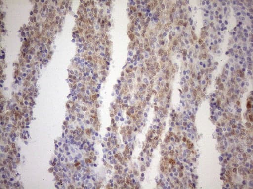 Monoclonal Mouse anti-Human POU2AF1 / BOB1 Antibody (clone OTI2D3, IHC, WB)
