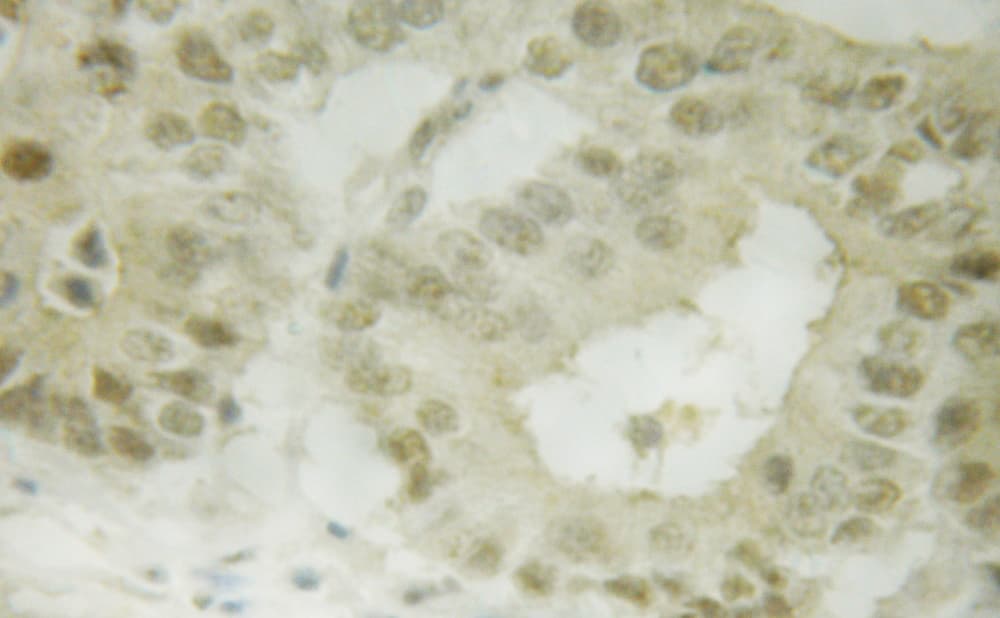 SMAD3 Antibody (phospho-Ser208)