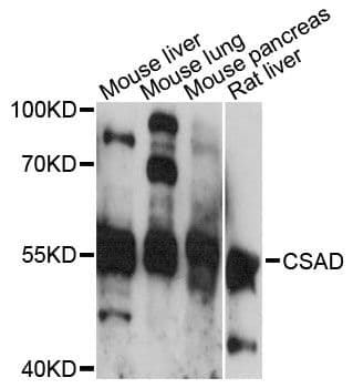 CSAD / CSD Antibody