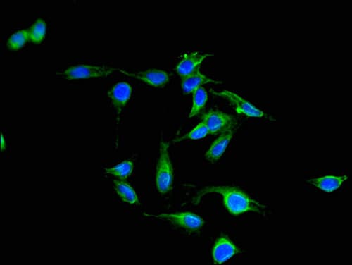 PAK3 Antibody