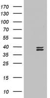 OTC Antibody (aa33-354, clone OTI8A9)