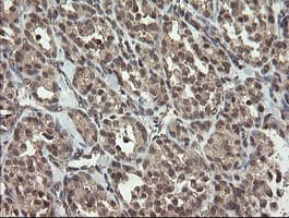 P3H1 / LEPRE1 Antibody (clone OTI1H3)