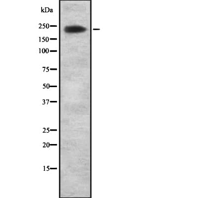 ARID1A / BAF250 Antibody