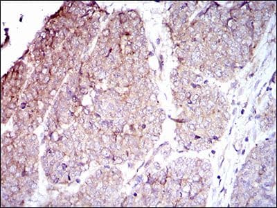 ITGB4 / Integrin Beta 4 Antibody (Amino Acid: 1619-1822, clone 10B10D5)
