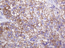 CTNND1 / p120 Catenin Antibody (clone OTI2E8)