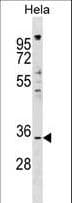 IMPACT Antibody (aa1-30)
