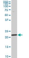 IHC-plus™ Monoclonal Mouse anti-Human RPS7 / Ribosomal Protein S7 Antibody (clone 3G4, IHC, IF, WB)