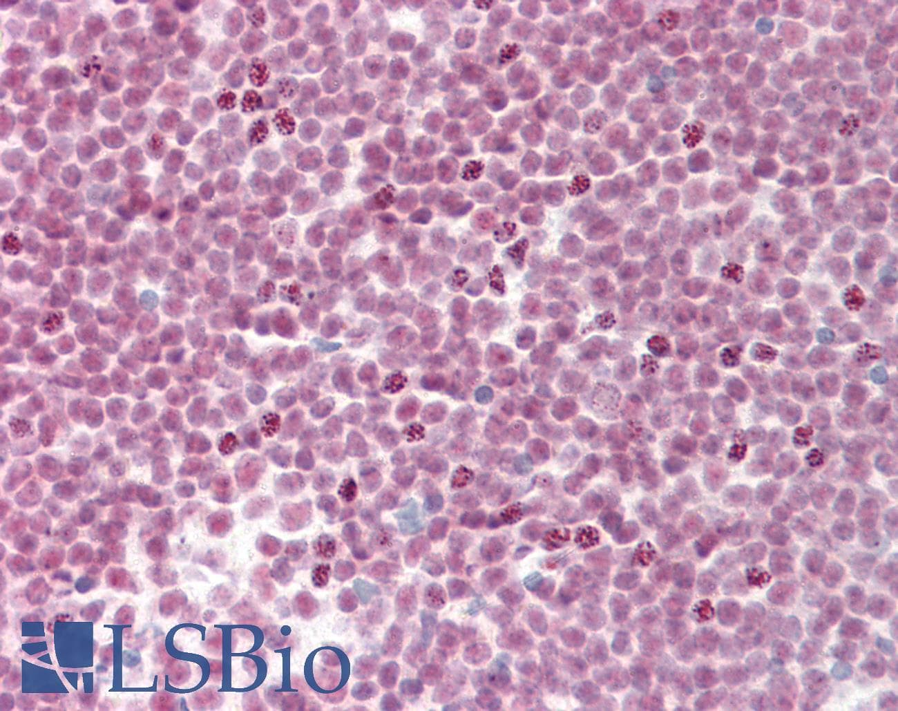 IHC-plus™ Monoclonal Mouse anti-Human SF3B4 Antibody (clone 3A1, IHC, IF, WB)