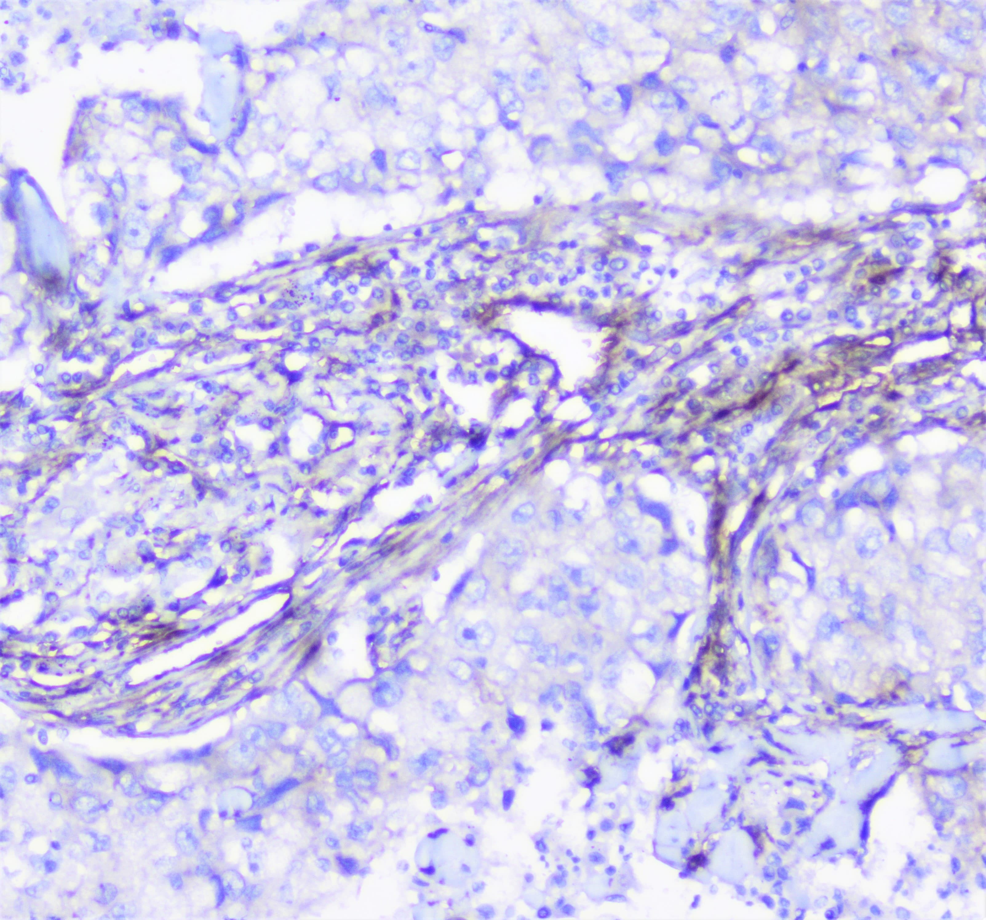 Polyclonal Rabbit anti-Human INPPL1 / SHIP2 Antibody (IHC, WB)