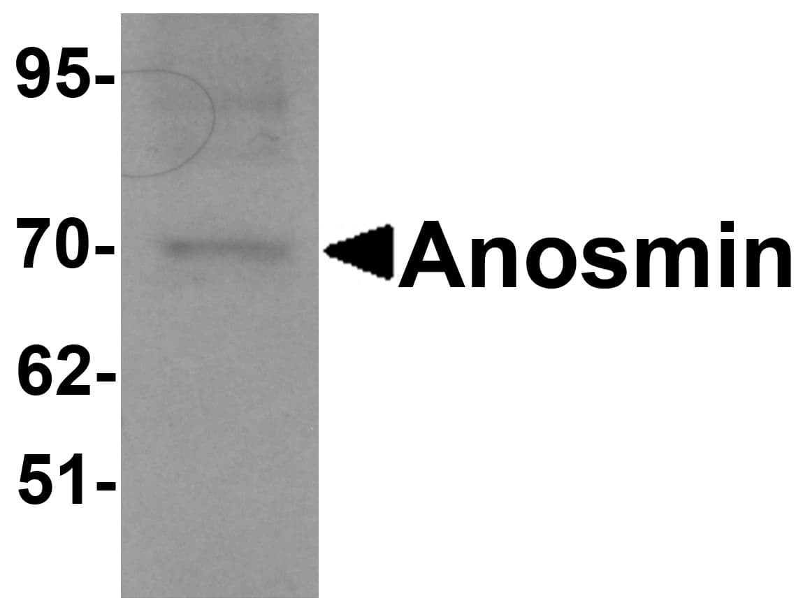 IHC-plus™ ANOS1 / Anosmin Antibody