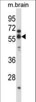 CHRNA5 Antibody (aa187-216)