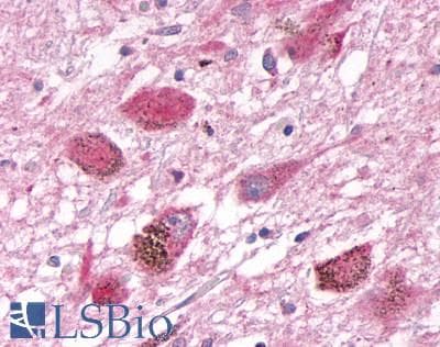 PathPlus™ DUSP26 / MKP8 Antibody (C-Terminus)