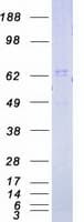 Human IRAK1 / IRAK Protein (Recombinant Myc-DDK (Flag))