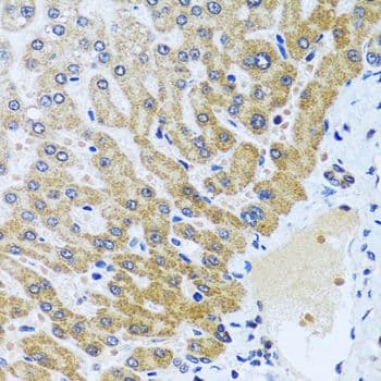 CPA6 / Carboxypeptidase A6 Antibody