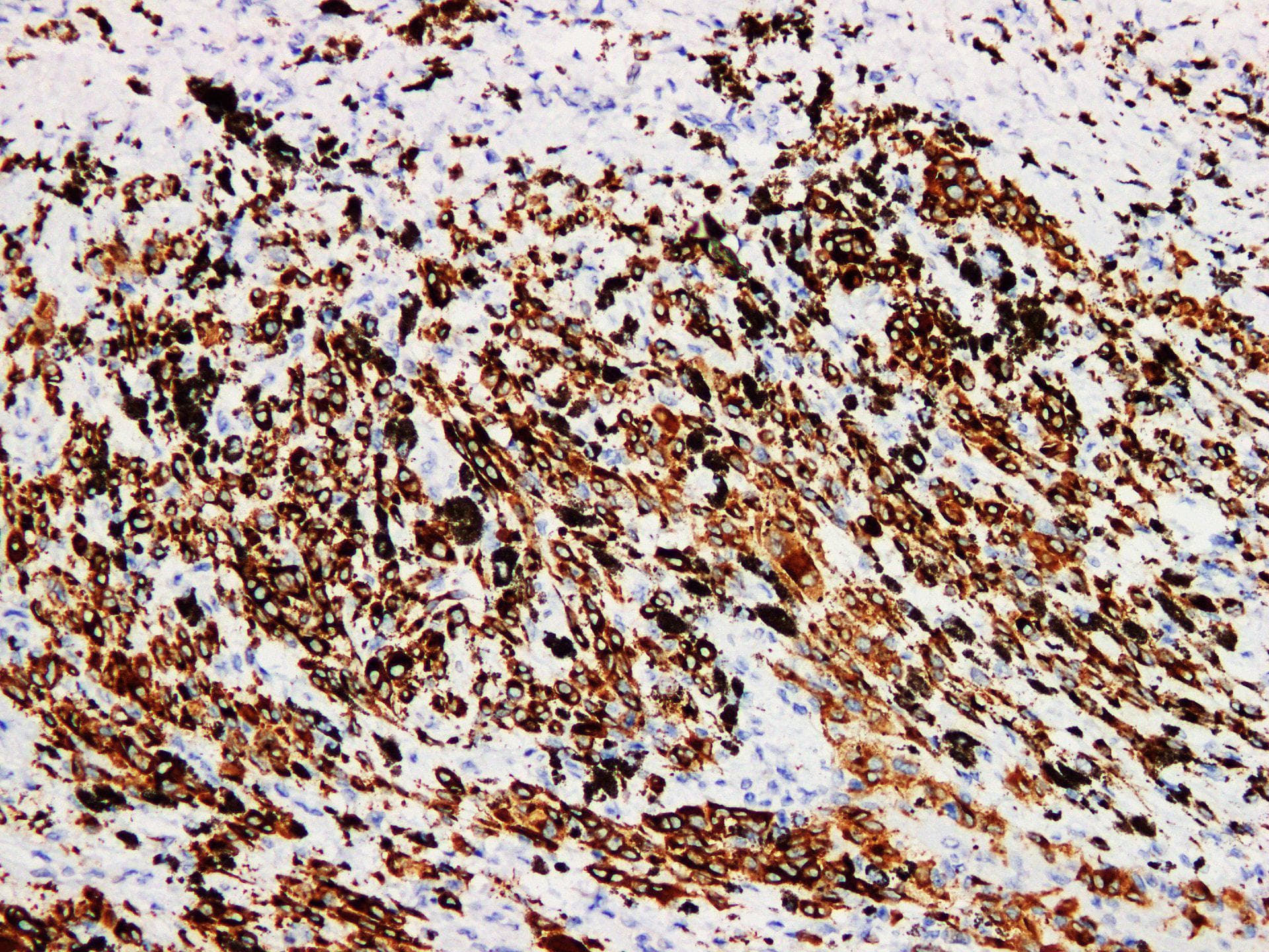 MLANA / Melan-A Antibody