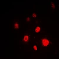 Polyclonal Rabbit anti-Human XRCC5 / Ku80 Antibody (C-Terminus, IHC, IF, WB)