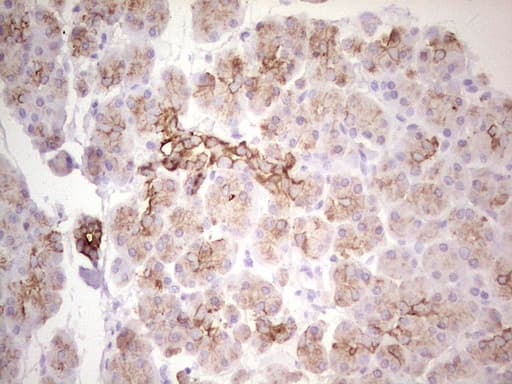 ABCB1 / MDR1 / P Glycoprotein Antibody (aa995-1280, clone OTI1A7)