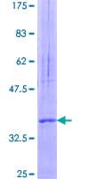 Human CYSTM1 / C5orf32 Protein (Recombinant GST)