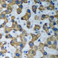 HADHA Antibody