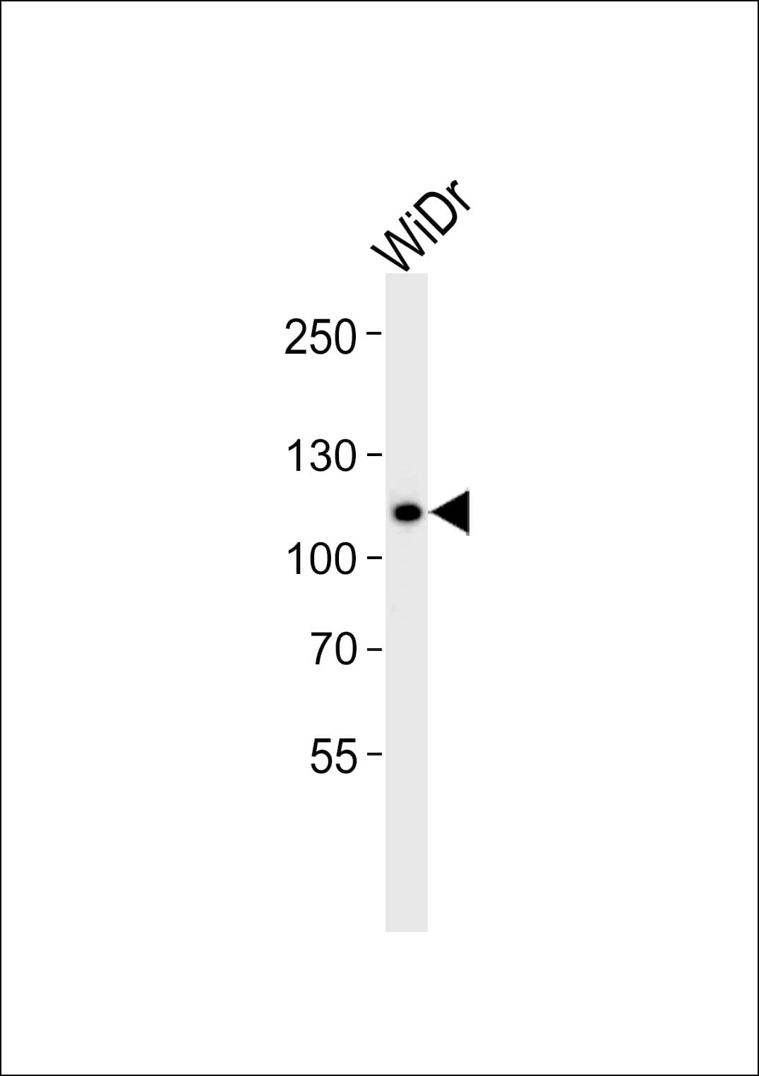 CARD6 Antibody