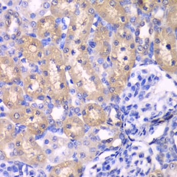 RPS6KB1 / P70S6K / S6K Antibody