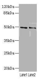 Polyclonal Rabbit anti-Human HTR3B / 5-HT3B Receptor Antibody (IHC, WB)
