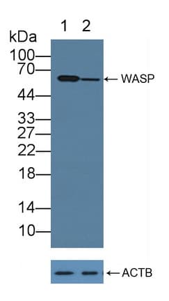 WAS / WASP Antibody (aa39-251)