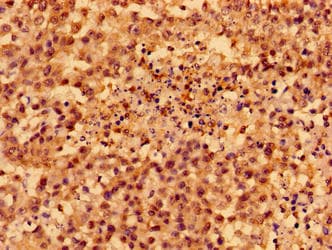 Polyclonal Rabbit anti-Human SMAD4 Antibody