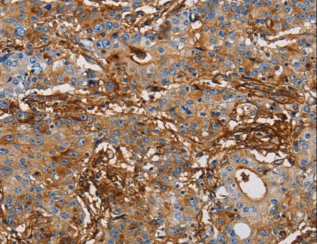 ICAM-1 / CD54 Antibody